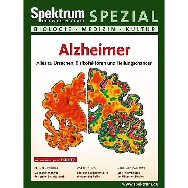 Alzheimer / Spektrum Spezial - Biologie, Medizin, Hirnforschung, Spektrum der Wissenschaft