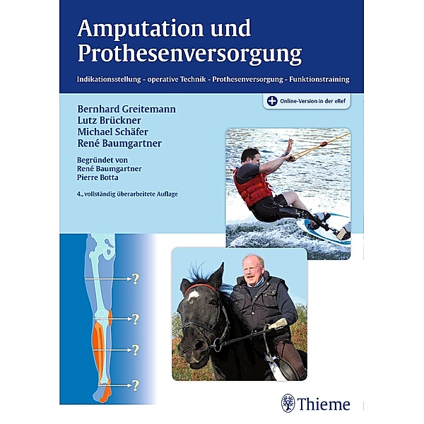 Amputation und Prothesenversorgung