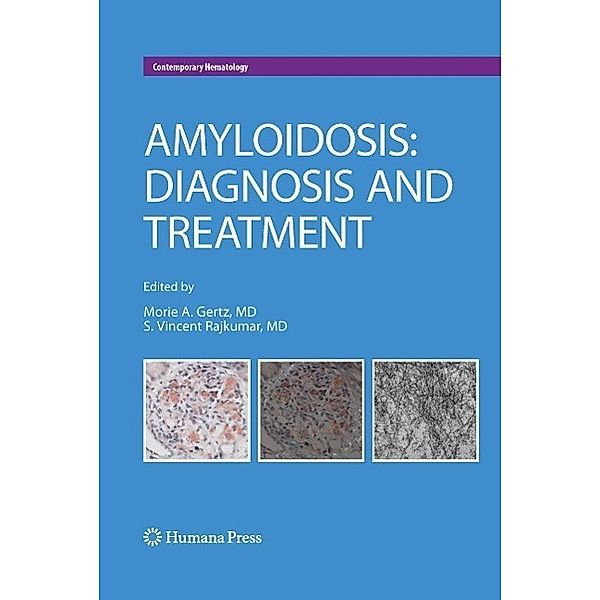 Amyloidosis / Contemporary Hematology