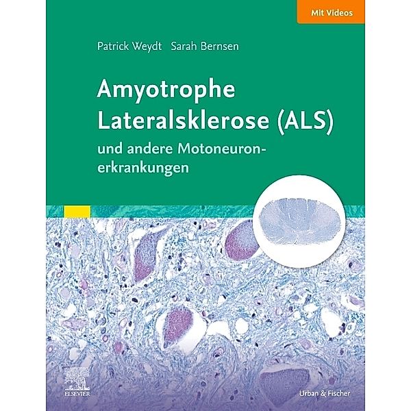 Amyotrophe Lateralsklerose (ALS) und andere Motoneuronerkrankungen, Patrick Weydt, Sarah Bernsen, Johannes Friese, Peter Körtvelyessy