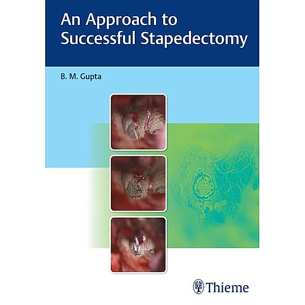 An Approach to Successful Stapedectomy, B. M. Gupta