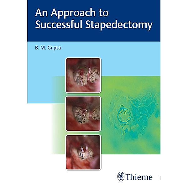 An Approach to Successful Stapedectomy, B Gupta