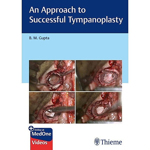 An Approach to Successful Tympanoplasty, B M Gupta