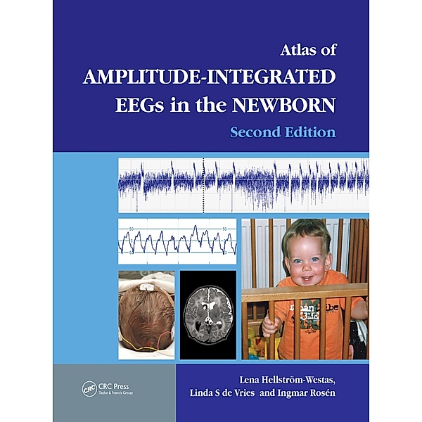 An Atlas of Amplitude-Integrated EEGs in the Newborn