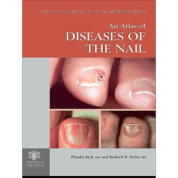 An Atlas of Diseases of the Nail, Phoebe Rich, Richard K. Scher