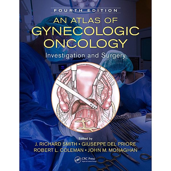 An Atlas of Gynecologic Oncology