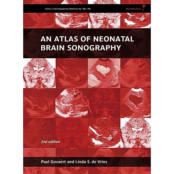 An Atlas of Neonatal Brain Sonography, 2nd Edition / 182, Paul Govaert, Linda S de Vries