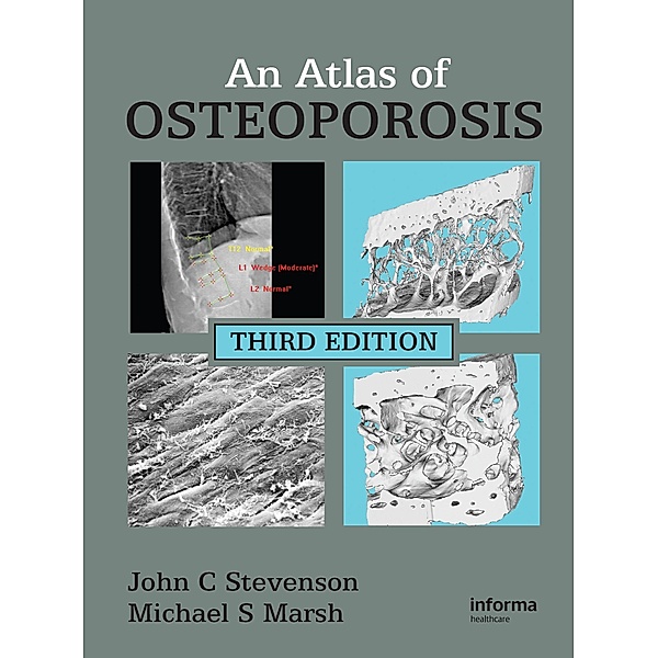 An Atlas of Osteoporosis, John C. Stevenson, Michael S. Marsh
