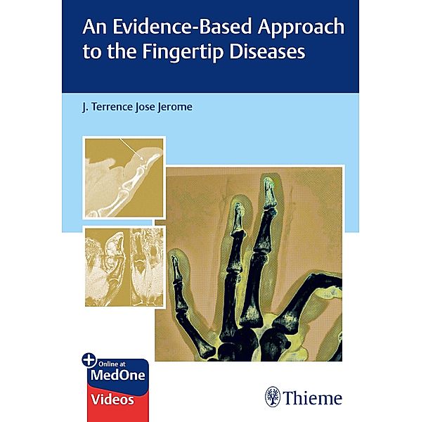 An Evidence-Based Approach to the Fingertip Diseases