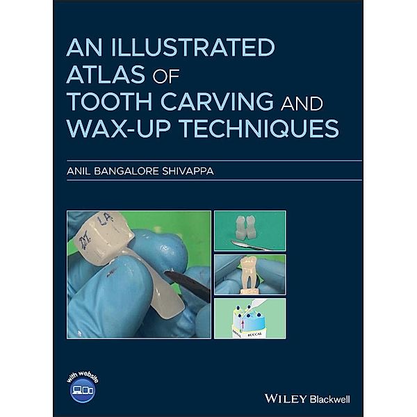 An Illustrated Atlas of Tooth Carving and Wax-Up Techniques, Anil Bangalore Shivappa