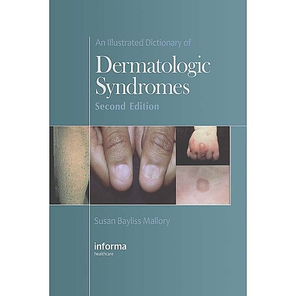 An Illustrated Dictionary of Dermatologic Syndromes, Susan B. Mallory