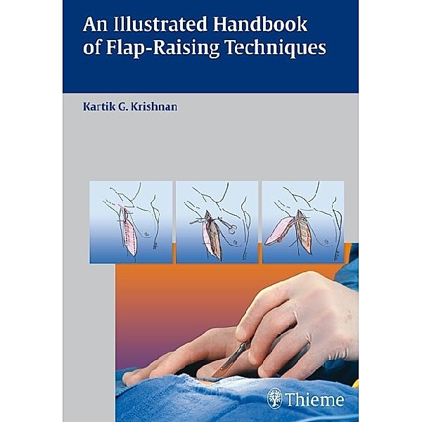 An Illustrated Handbook of Flap-Raising Techniques, Kartik G. Krishnan