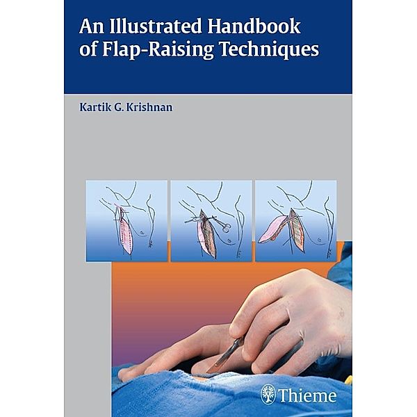 An Illustrated Handbook of Flap-Raising Techniques, Kartik G. Krishnan