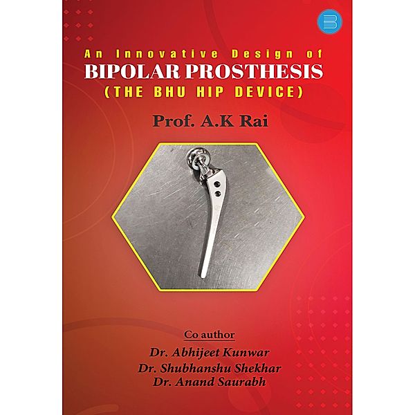 An innovative design of bipolar prosthesis, Anil Kumar Rai