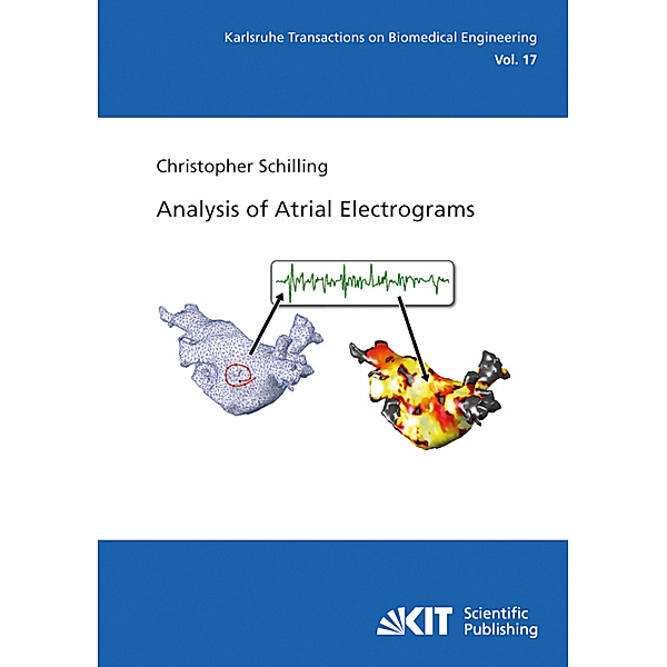 Analysis of Atrial Electrograms, Christopher Schilling