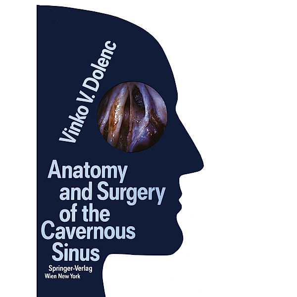 Anatomy and Surgery of the Cavernous Sinus, Vinko V. Dolenc