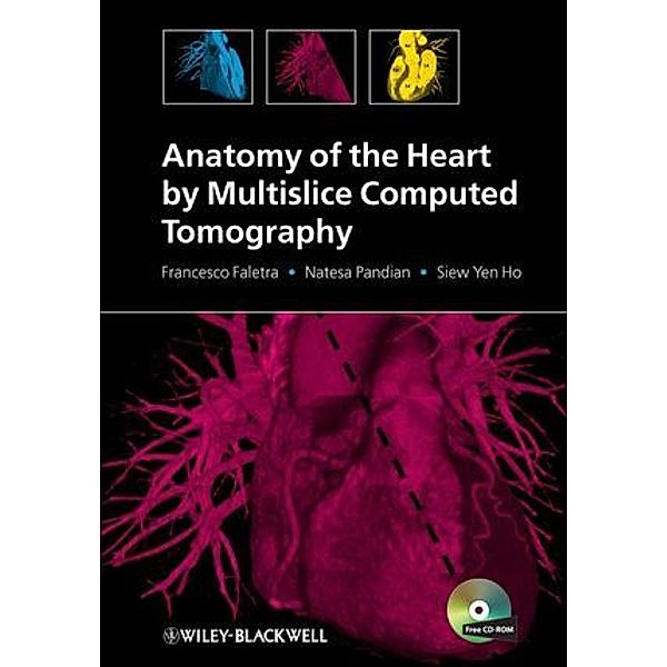 Anatomy of the Heart by Multislice Computed Tomography with CD-ROM, Francesco Faletra, Natesa Pandian, Siew Yen Ho