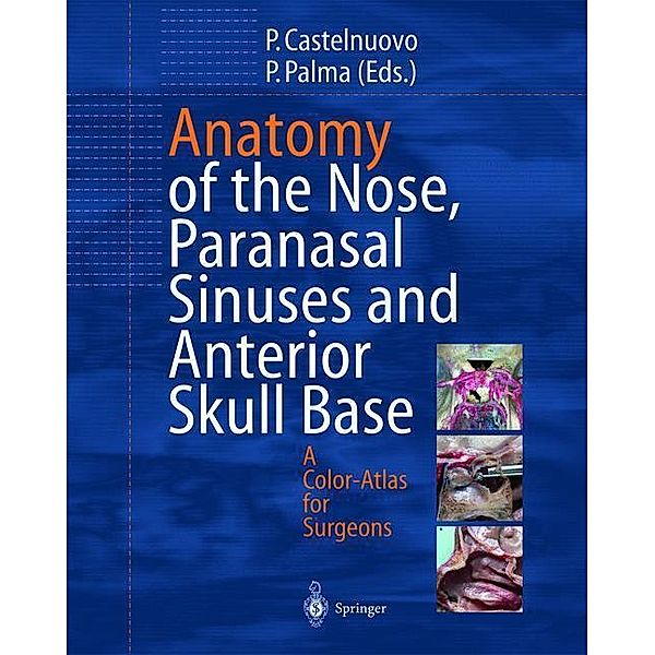 Anatomy of the Nose, Paranasal Sinuses and Anterior Skull Base