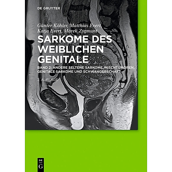 Andere seltene Sarkome, Mischtumoren, genitale Sarkome und Schwangerschaft.Bd.2, Günter Köhler, Matthias Evert, Katja Evert, Marek Zygmunt