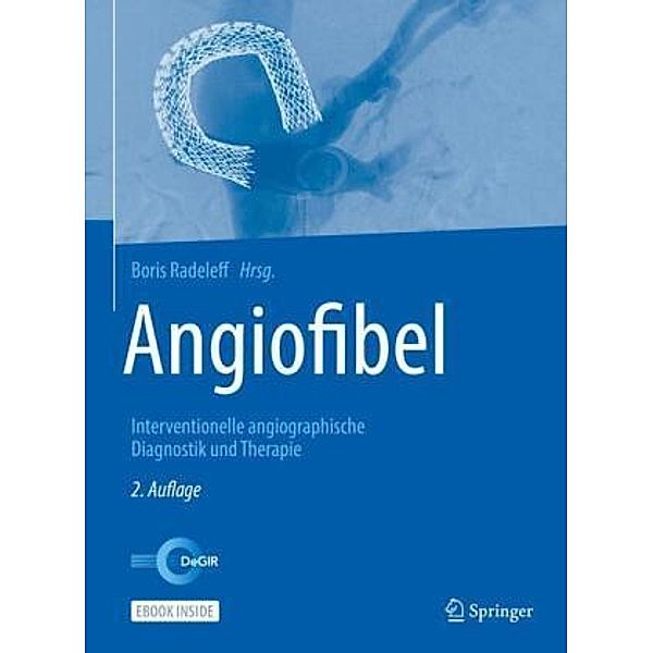 Angiofibel, m. 1 Buch, m. 1 E-Book