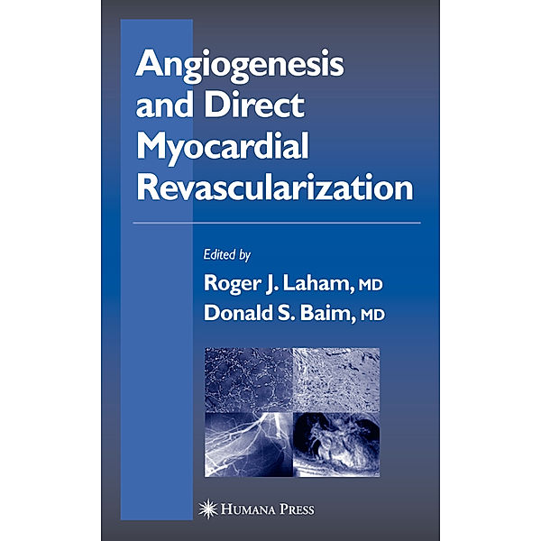 Angiogenesis and Direct Myocardial Revascularization