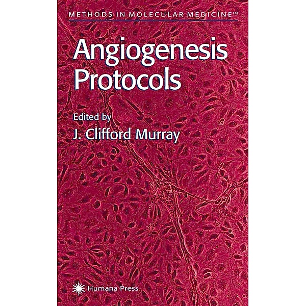 Angiogenesis Protocols / Methods in Molecular Medicine Bd.46