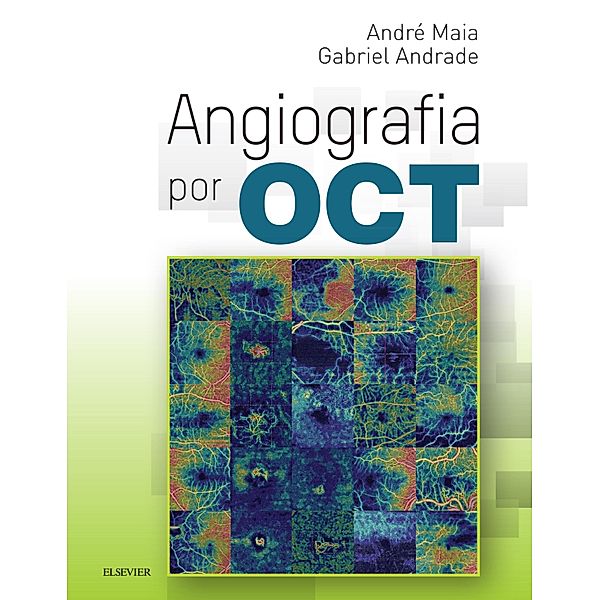 Angiografia por OCT, Gabriel Costa de Andrade, Andre Correa Maia de Carvalho