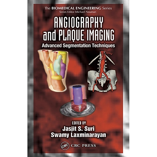 Angiography and Plaque Imaging