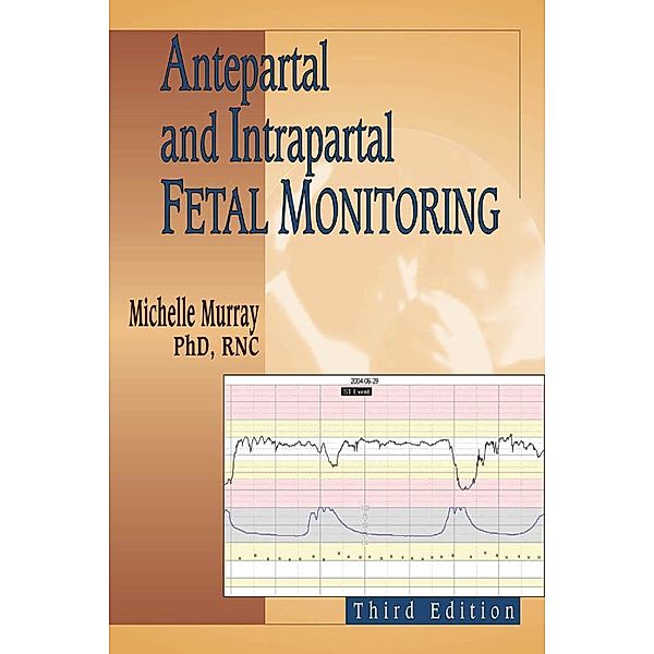 Antepartal and Intrapartal Fetal Monitoring, Michelle Murray