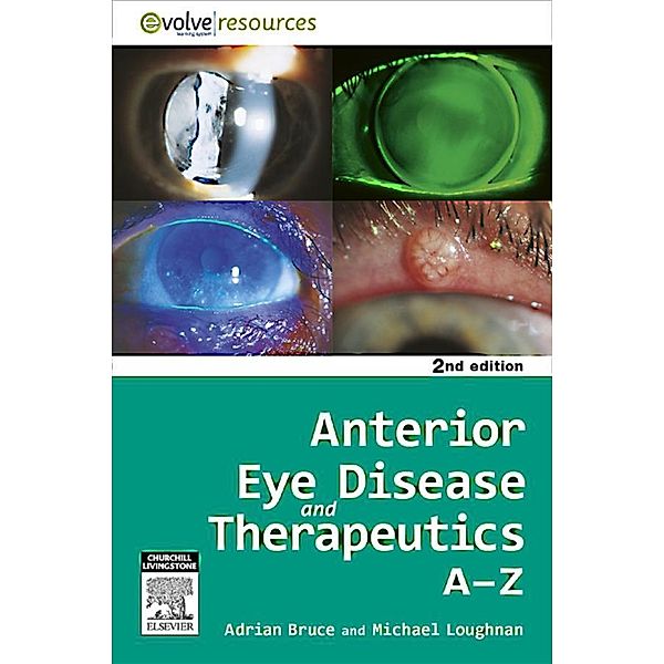 Anterior Eye Disease and Therapeutics A-Z - E-Book, Adrian S. Bruce, Michael Stephen Loughnan