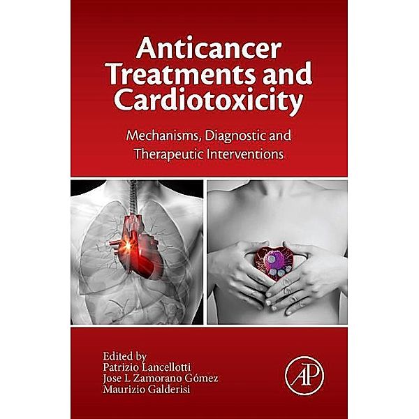 Anticancer Treatments and Cardiotoxicity, Patrizio Lancellotti, Jose L. Zamorano, Maurizio Galderisi