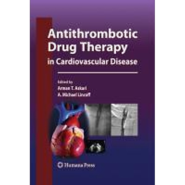 Antithrombotic Drug Therapy in Cardiovascular Disease / Contemporary Cardiology