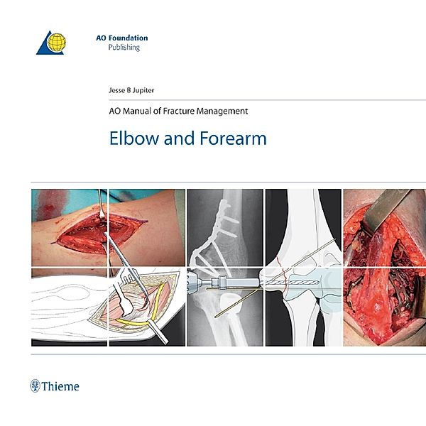 AO Manual of Fracture Management - Elbow and Forearm / AO-Publishing, Jesse Jupiter