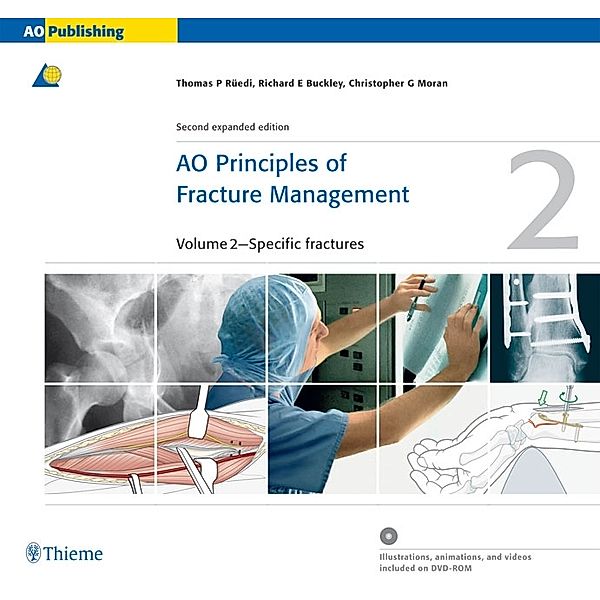 AO Principles of Fracture Management, 2 Vols. w. DVD-ROM, Thomas P. Rüedi, Richard E. Buckley, Christopher G. Moran