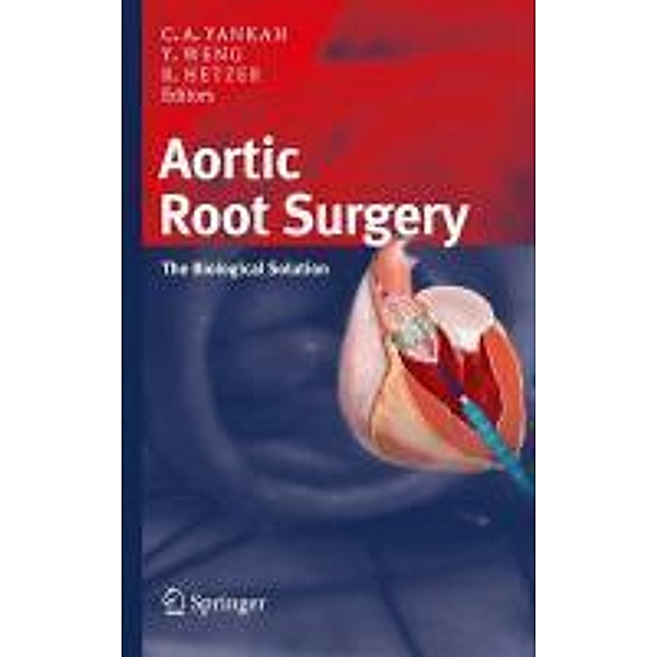 Aortic Root Surgery, Matthias Bechtel, Lenard Conradi, Sven Beholz