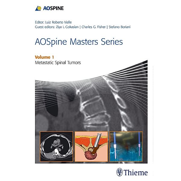 AOSpine Masters Series Volume 1: Metastatic Spinal Tumors / AOSpine Masters Series, Ziya L. Gokaslan, Charles G. Fisher