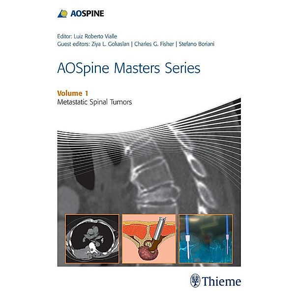 AOSpine Masters Series, Volume 1: Metastatic Spinal Tumors / AOSpine Masters Series Bd.1