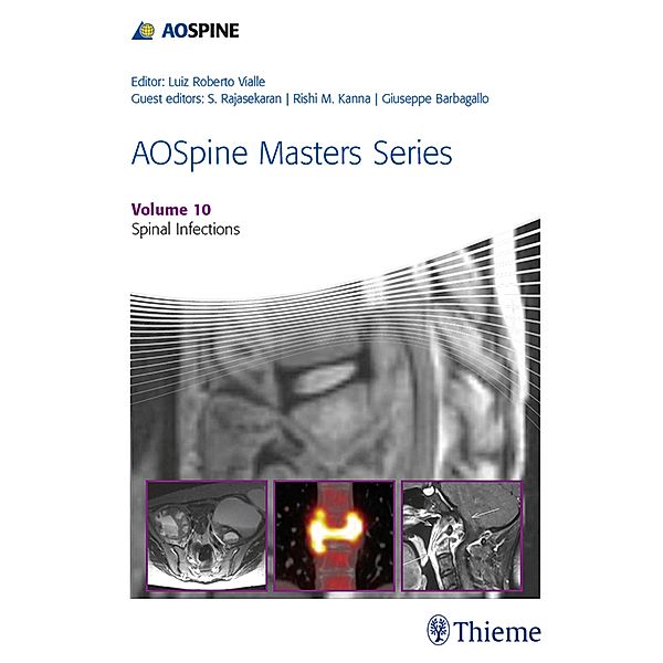 AOSpine Masters Series, Volume 10: Spinal Infections / AOSpine Masters Series