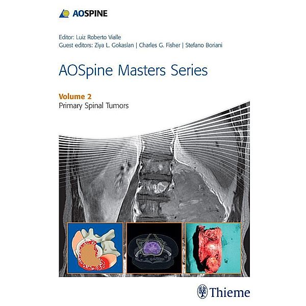 AOSpine Masters Series, Volume 2: Primary Spinal Tumors / AOSpine Masters Series Bd.2