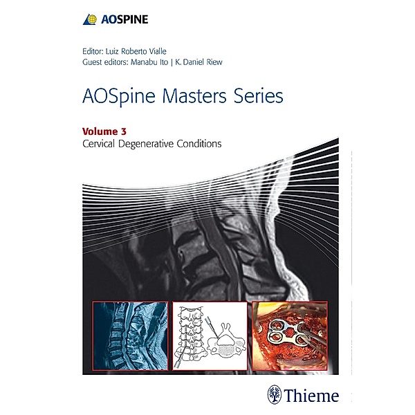 AOSpine Masters Series, Volume 3: Cervical Degenerative Conditions / AOSpine Masters Series, Manabu Ito, K. Daniel Riew