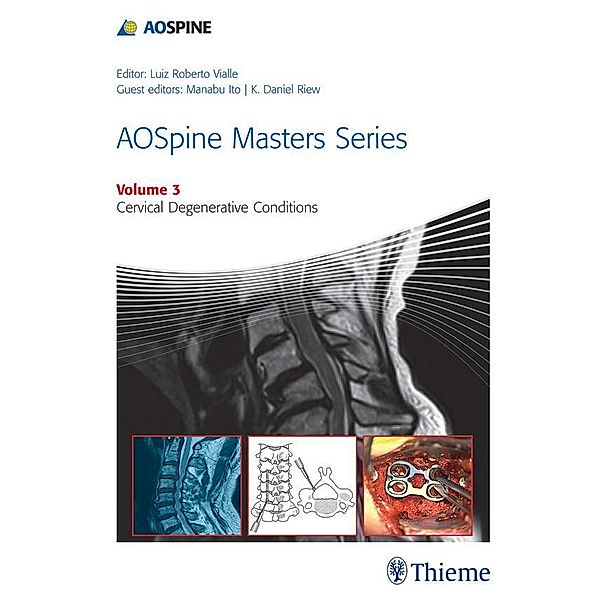 AOSpine Masters Series, Volume 3: Cervical Degenerative Conditions / AOSpine Masters Series Bd.3