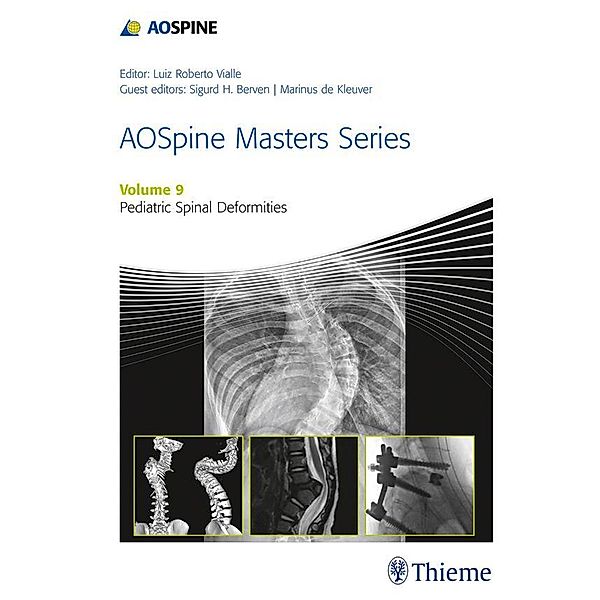 AOSpine Masters Series, Volume 9: Pediatric Spinal Deformities / AOSpine Masters Series Bd.9