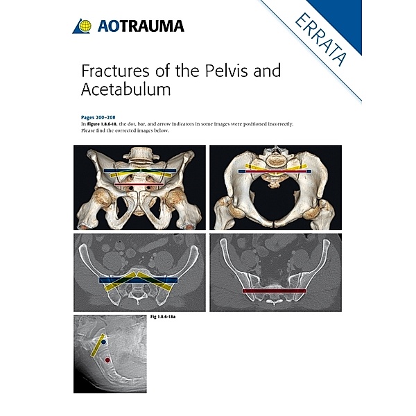 AOTrauma / Fractures of the Pelvis and Acetabulum, Mark S. Vrahas