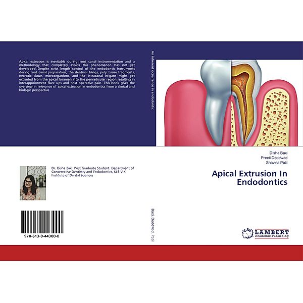 Apical Extrusion In Endodontics, Disha Baxi, Preeti Doddwad, Shavina Patil