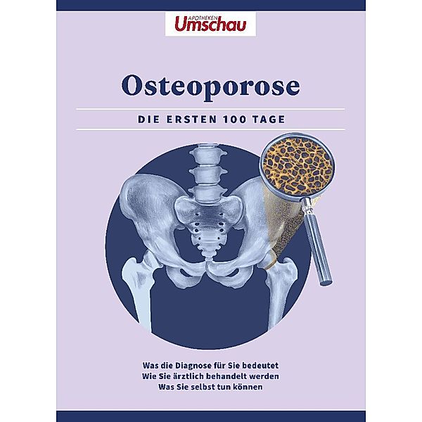 Apotheken Umschau: Osteoporose