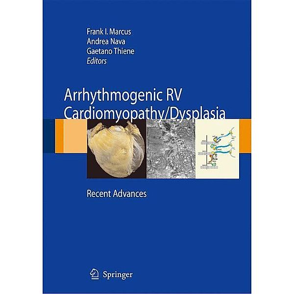 Arrhythmogenic RV Cardiomyopathy/Dysplasia