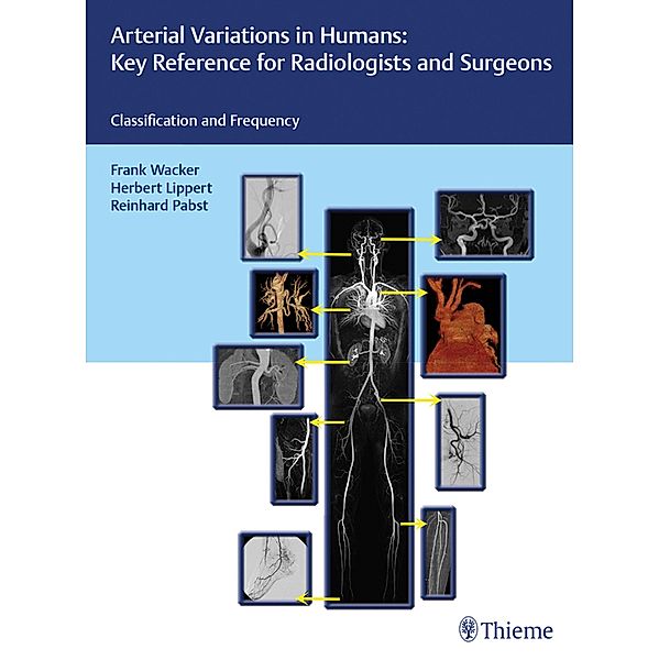 Arterial Variations in Humans: Key Reference for Radiologists and Surgeons