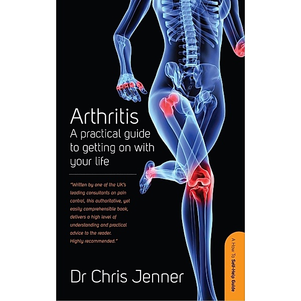 Arthritis, Chris Jenner