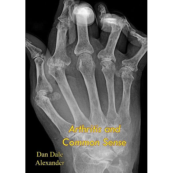 Arthritis and Common Sense, Dan Dale Alexander