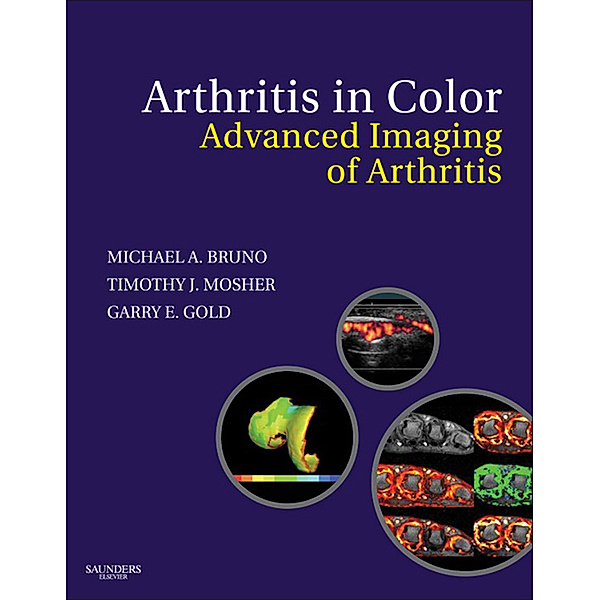 Arthritis in Color E-Book, Gary E. Gold, Michael A. Bruno, Timothy J. Mosher